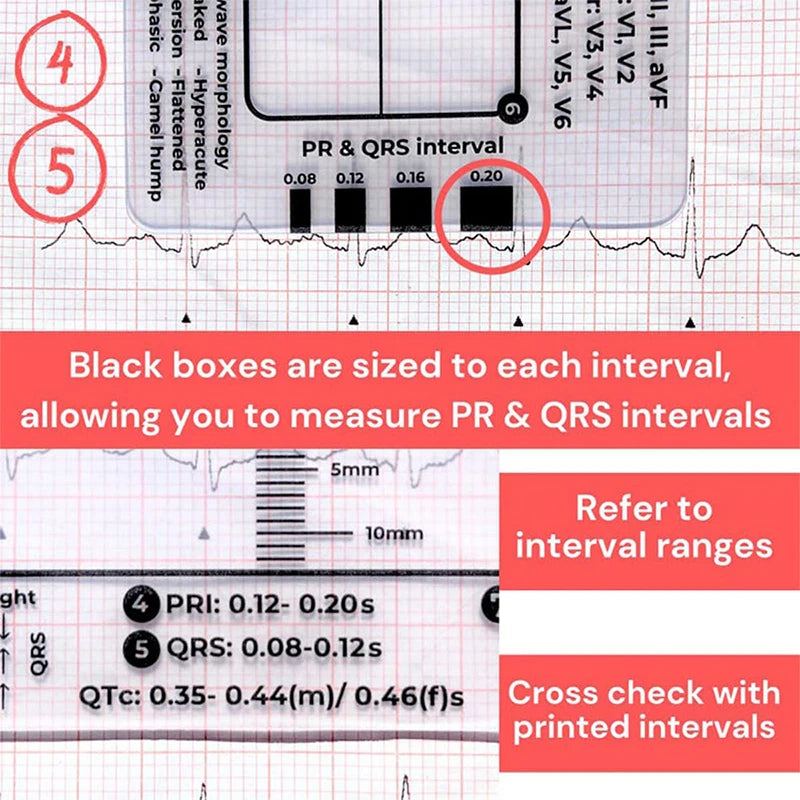 An ECG ruler card showing PR and QRS intervals marked with black boxes for measurement.