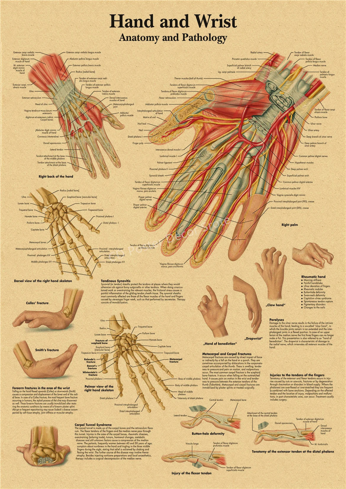 Vintage anatomy and pathology poster showing hand and wrist anatomy and pathology details on kraft paper