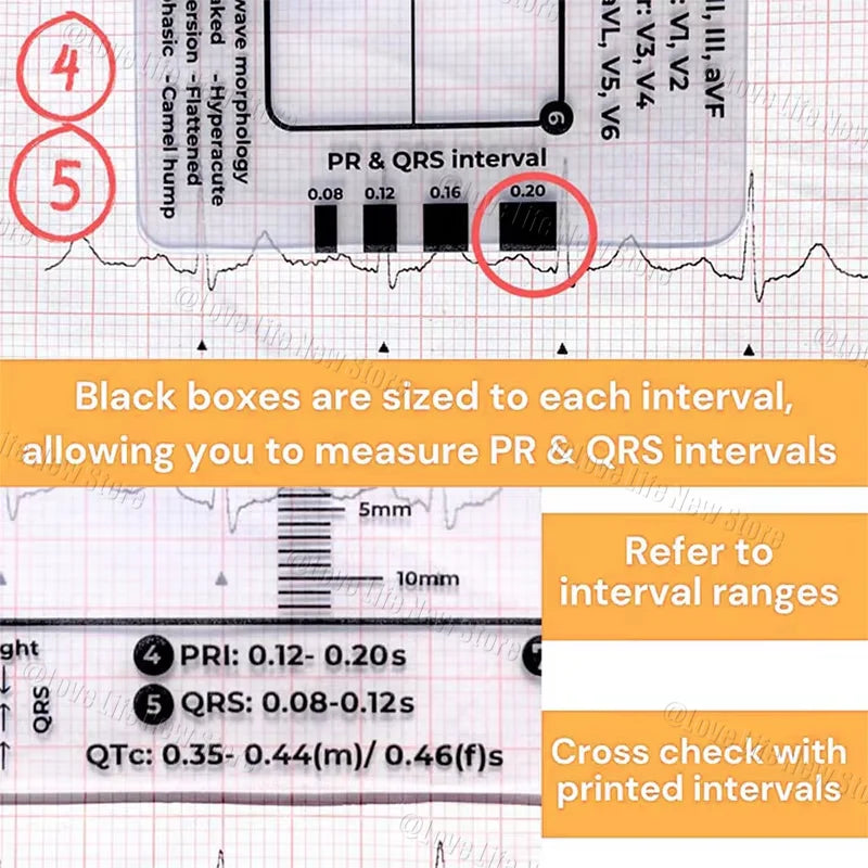 An ECG ruler card showing markings for PR and QRS intervals with labeled boxes for measurement.