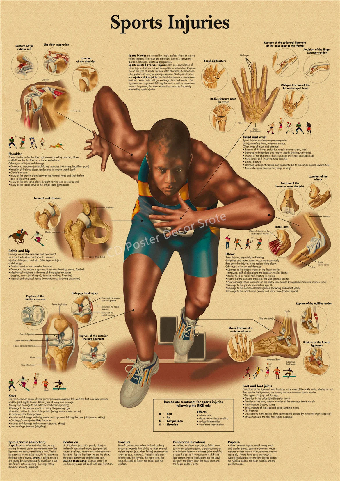 Poster showing various sports injuries and anatomy, including fractures, sprains, and muscle damage.