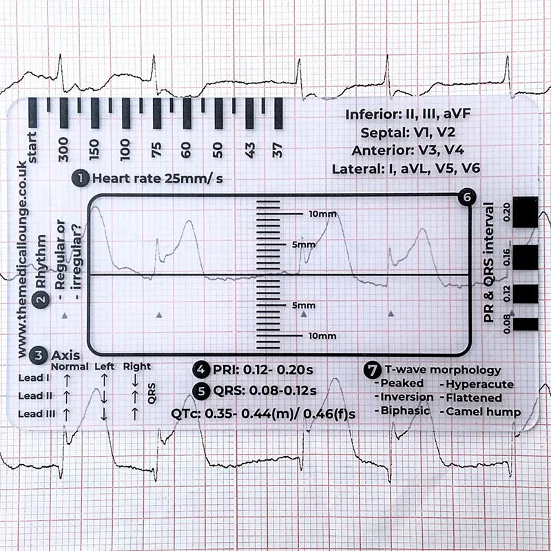 A printed card showing a 7-step ECG ruler for EKG interpretation with various waveforms and measurements.