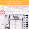An ECG ruler card showing a heart rhythm strip for assessing regularity.
