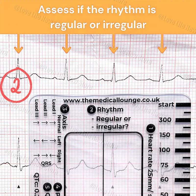 An ECG ruler card showing a heart rhythm strip for assessing regularity.