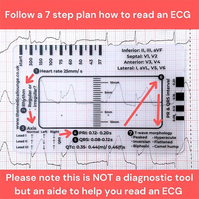 A guide showing a 7-step plan for reading an ECG, detailing waveform analysis and interpretation steps.