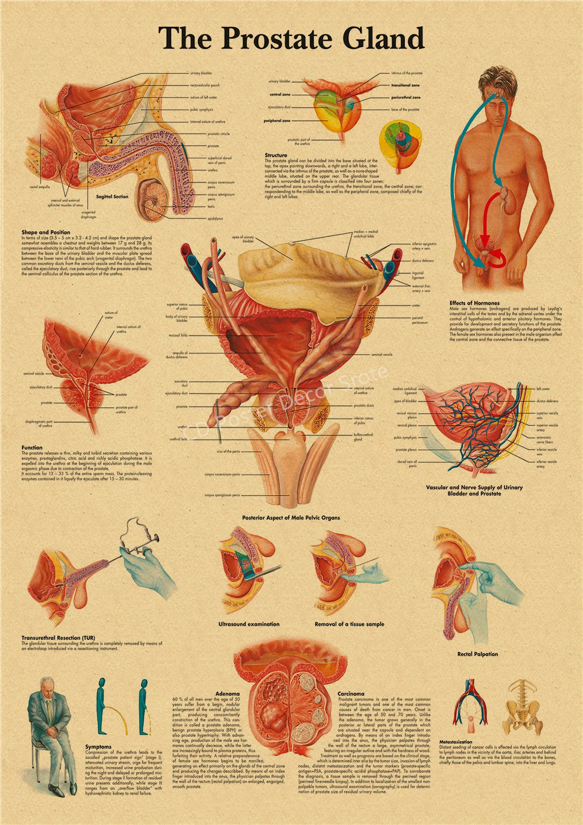 Vintage anatomy poster detailing the structure, function, and effects of the prostate gland.