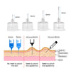 A comparison chart showing sterile insulin pen needles of various gauges (4mm to 8mm) and their required penetration depth in