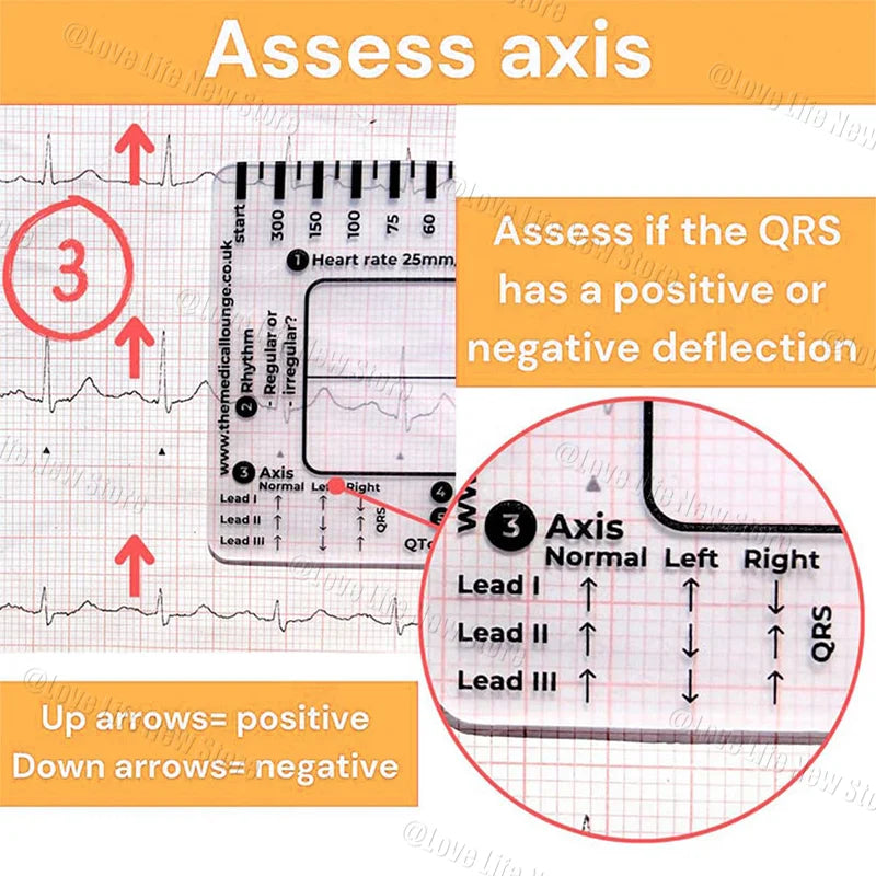 An ECG ruler card showing how to assess the axis using positive or negative deflections for Lead I, II, and III.
