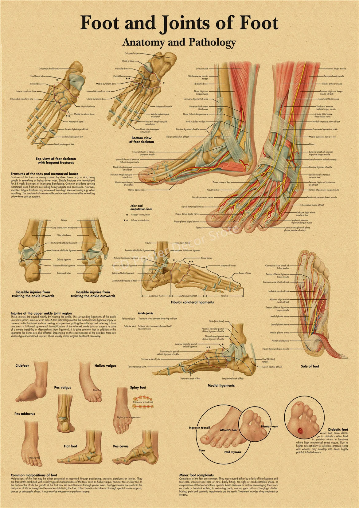 Anatomy and Pathology of the foot and joints, showing skeletal structures and ligaments.