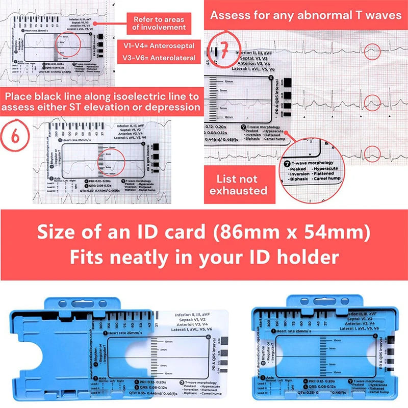 A blue plastic card with ECG markings and a ruler for measuring T waves and other cardiac features.